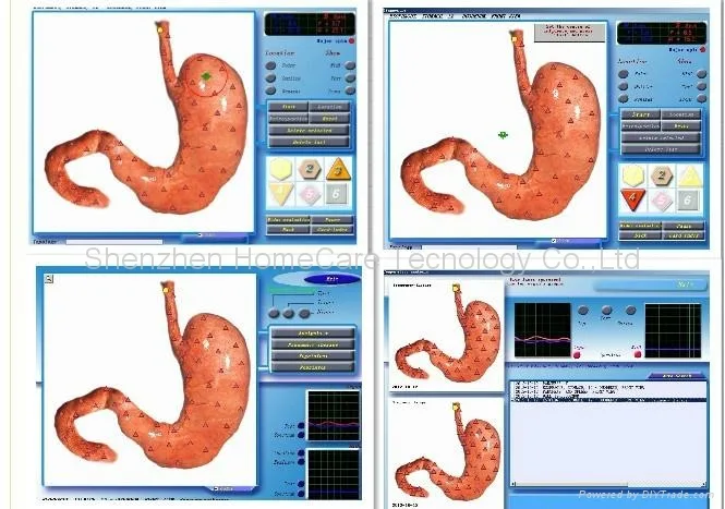 The newest 3D NLS health analyzer 2