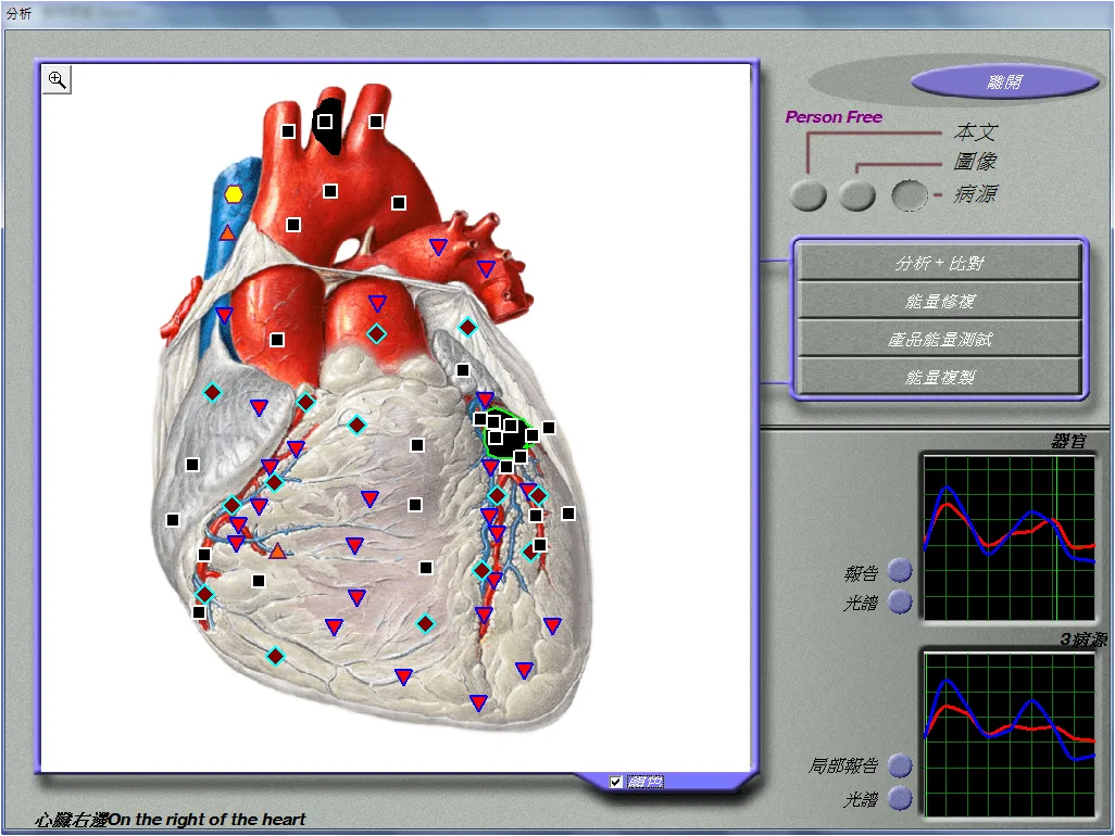 3D DIACOM NLS analyzer 4
