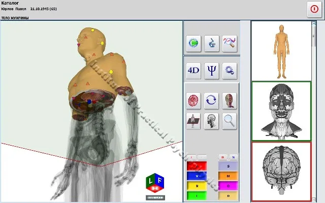 3D DIACOM NLS analyzer2