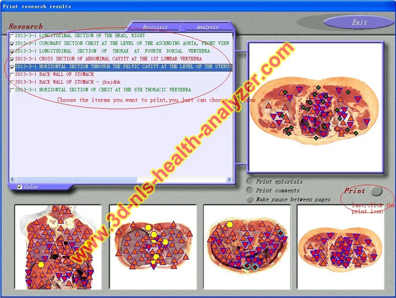 3D nls health analyzer 1