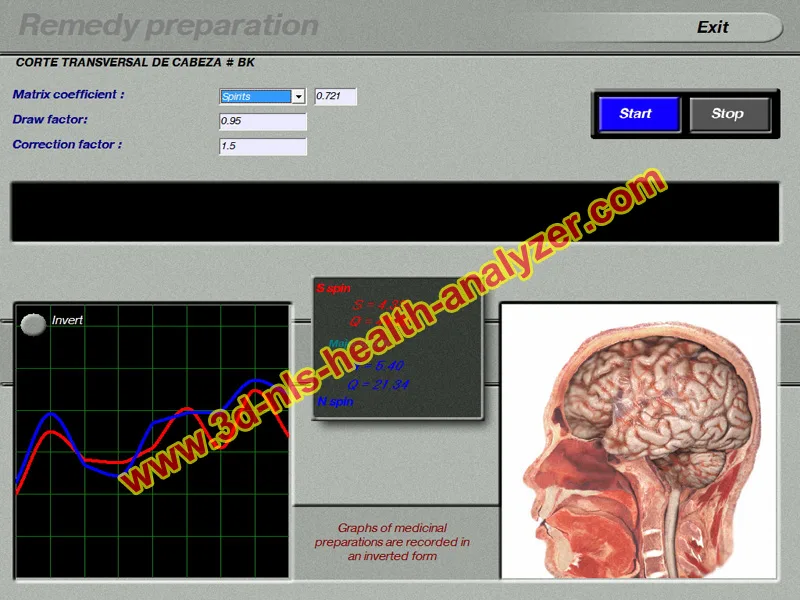 3D nls health analyzer 25