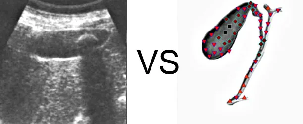 Comparison with ULTRASOUND STUDY  5
