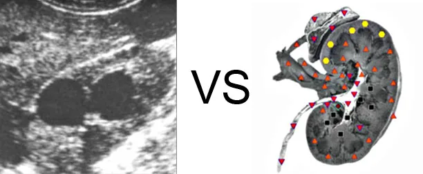 Comparison with ULTRASOUND STUDY 9