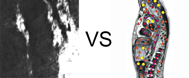 Comparison with ULTRASOUND STUDY
