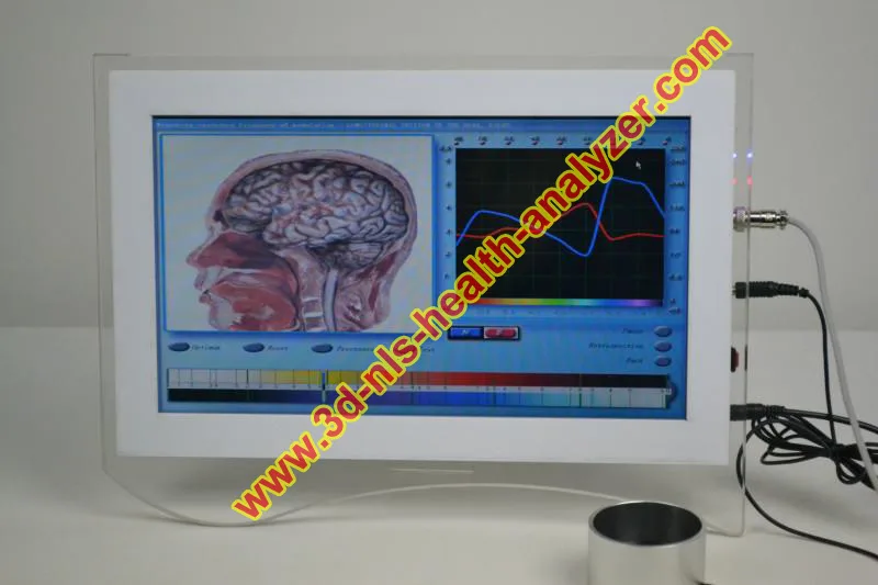 Professional 3D NLS health care diagnostic equipment touch screen
