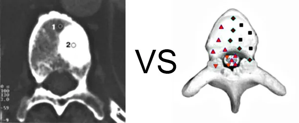 Vs. Computer Tomography 2 Vs. Computer Tomography (1)