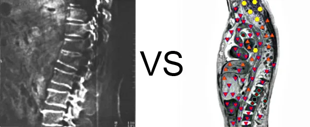 Vs. Computer Tomography 4 Vs. Computer Tomography (3)
