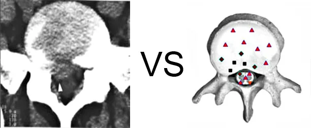 Vs. Computer Tomography 1 Vs. Computer Tomography