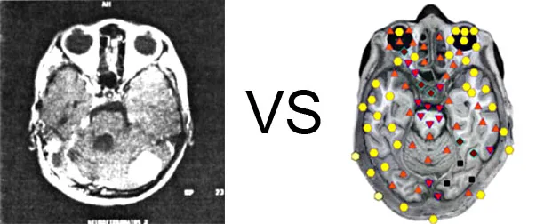Vs. NMR1