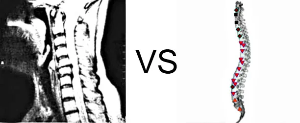 Vs. NMR10