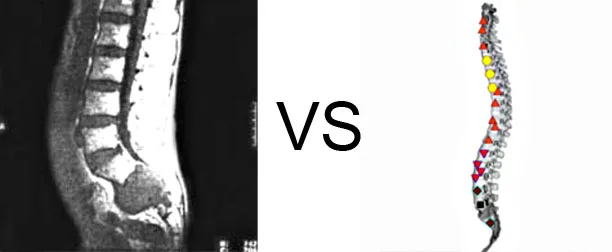 Vs. NMR11