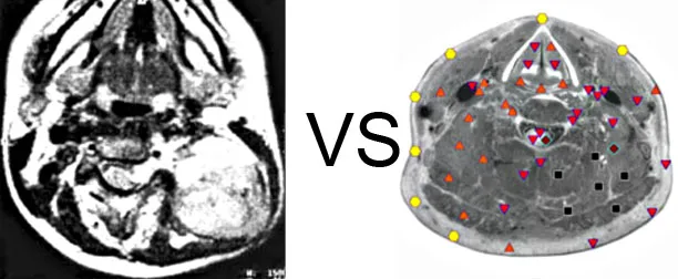 Vs. NMR12