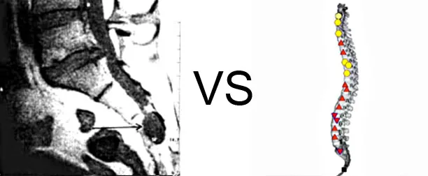 Vs. NMR13