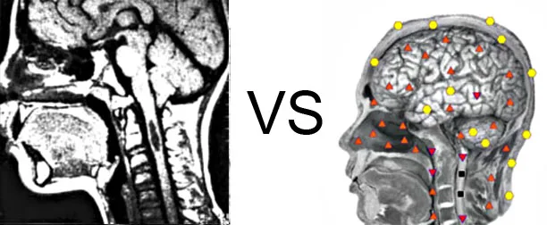 Vs. NMR14