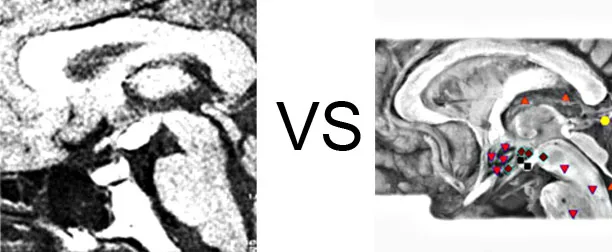 Vs. NMR2