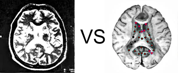 Vs. NMR3