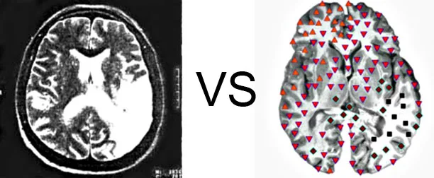 Vs. NMR4