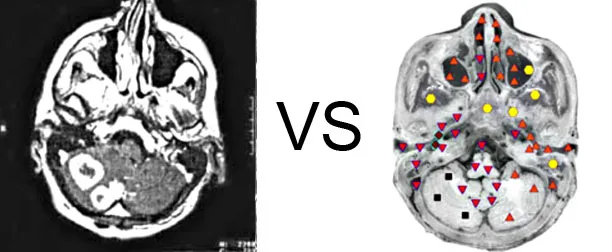 Vs. NMR7