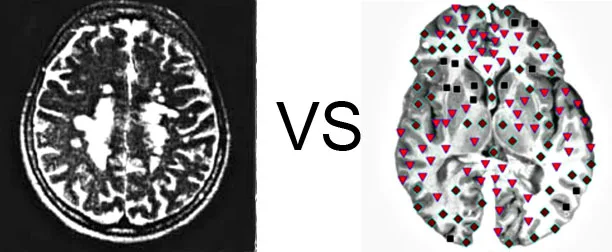 Vs. NMR8