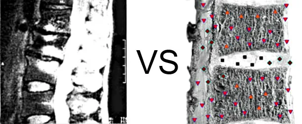 Vs. NMR9