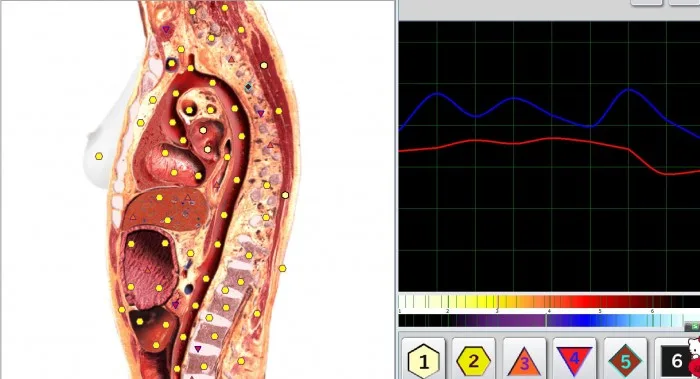 Bioresonance Therapy Device Metatron NlS 4025 Hunter for full body scan Treatment and Prostate software