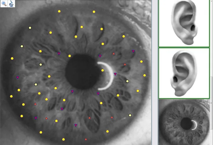 Black Virtual Scanning High Accuracy Metatron Nls 4025 Hunter Body Analyzer Multilanguage software