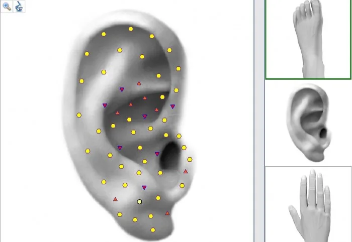 Clinical Version Metatron NlS Hunter 4025 Sub Health Analyzer for Hypertension Detector software
