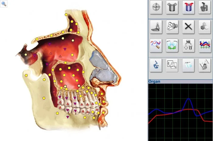 Human Health Composition Metatron NLS 4025 Hunter Body Analyser Machine software 2
