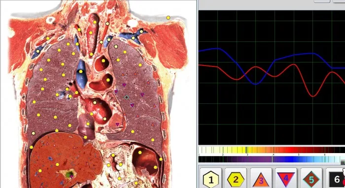 Newest Metatron Hunter NLS System 4025 Bioresonance Health Scan and Therapy software