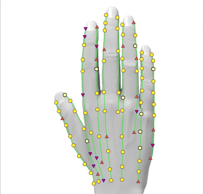 Nonlinear Detection Equipment Metatron NLS System Hunter 4025 for Full Body Health Analyzer software