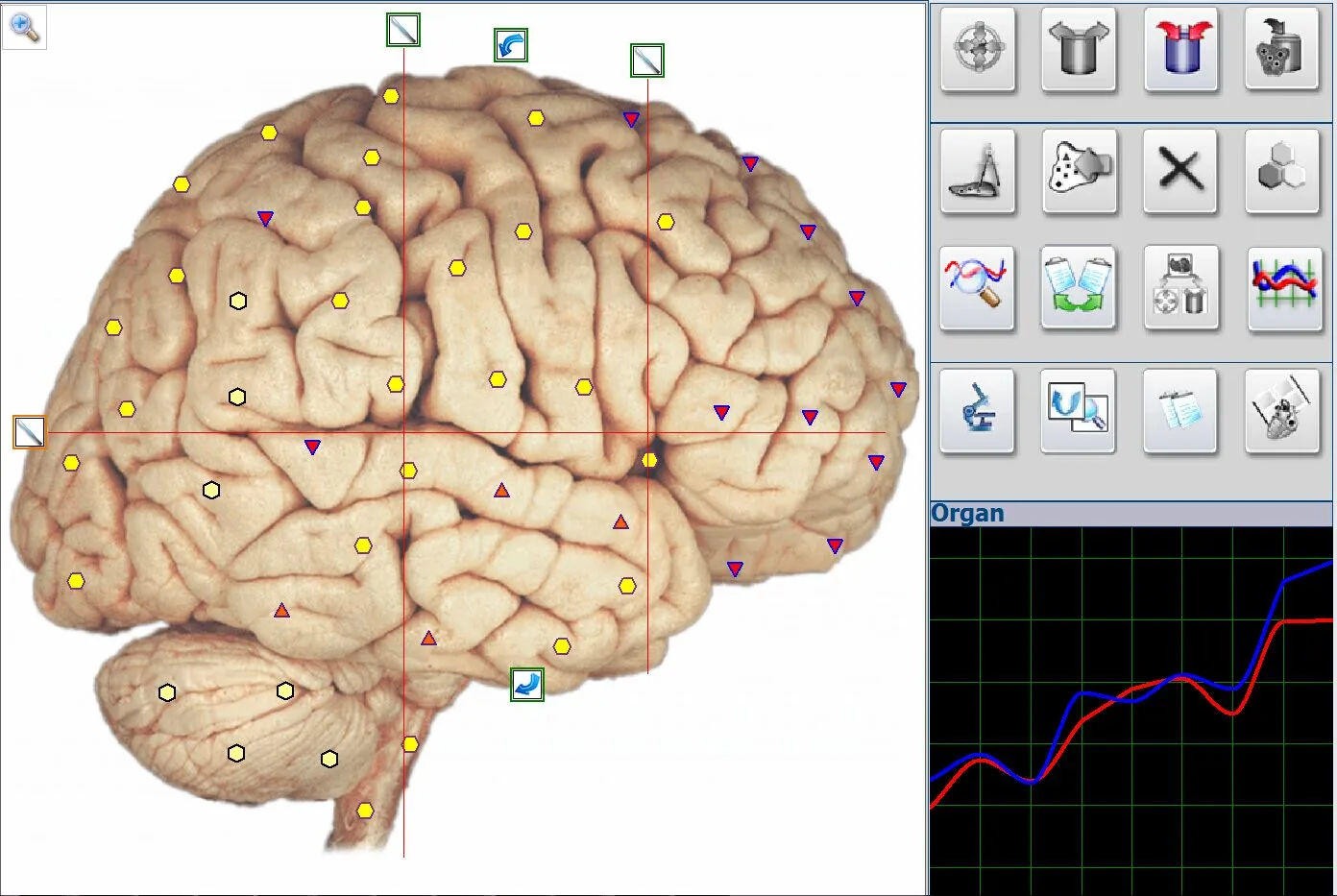 Nuclear Magnetic Resonance Metatron Nls 4025 Hunter Upgraded Version High Accuracy software