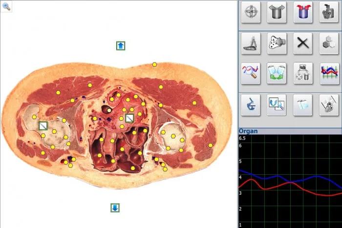 Portable Biofeedback Health Analyzer Metatron Nls 4025 Hunter for Quantum Detector High Accuracy software