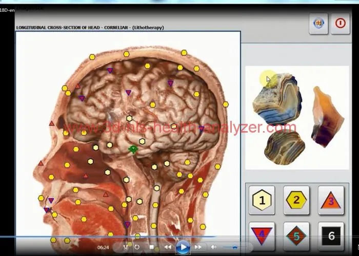 18D lithotherapy picture-4