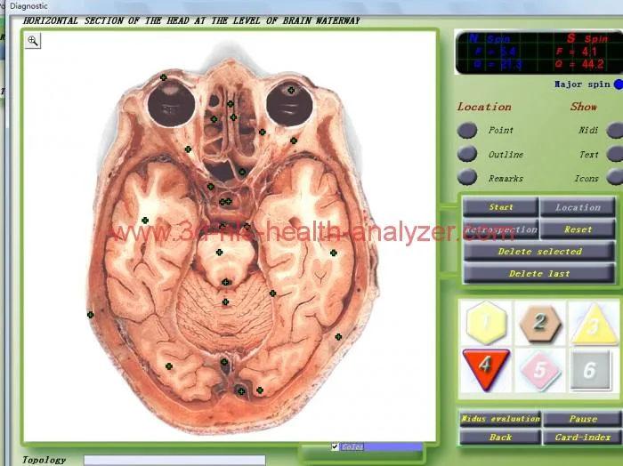 diagnostic for test