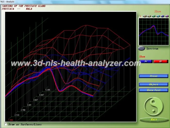 3d nls health analyzer ebay