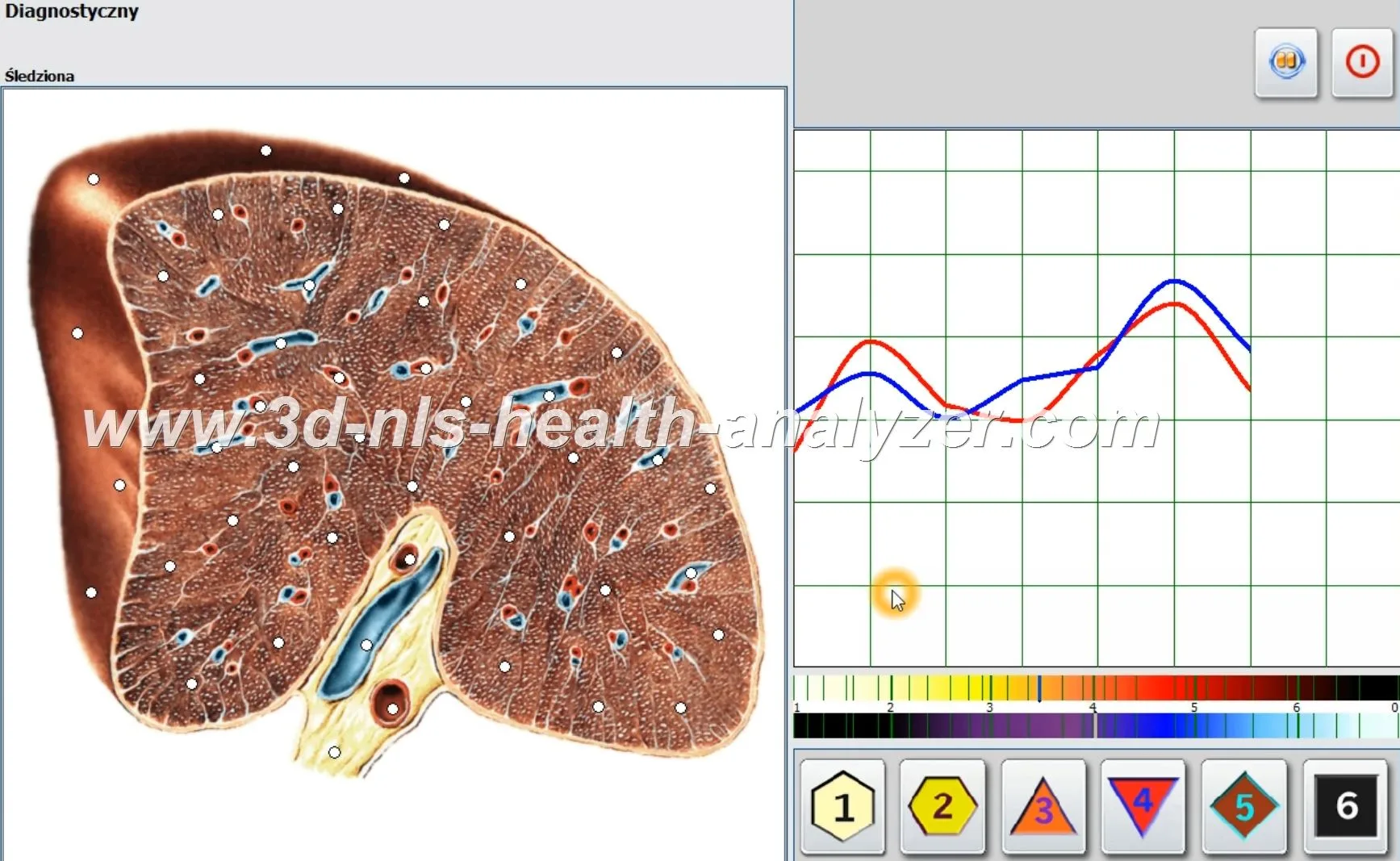 metatron 4025 clinical