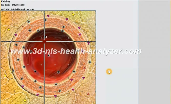 metatron nls diagnostic
