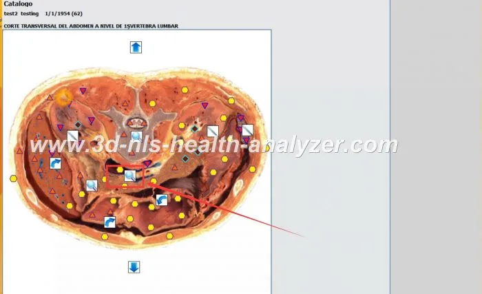 oberon diagnostik-nls analyse