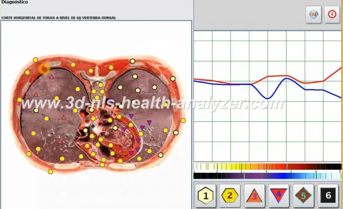 oberon nls diagnostic device
