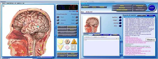 What is bio escaner 3d 2