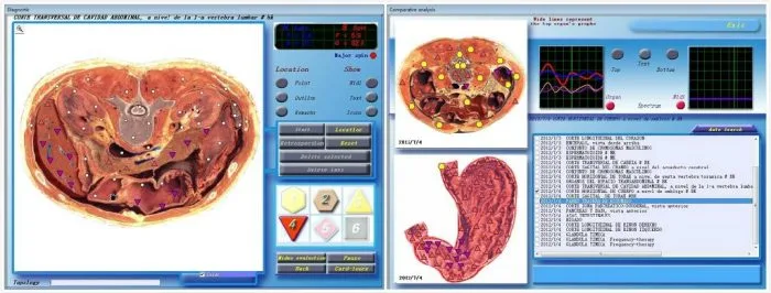 diacom nls software 11