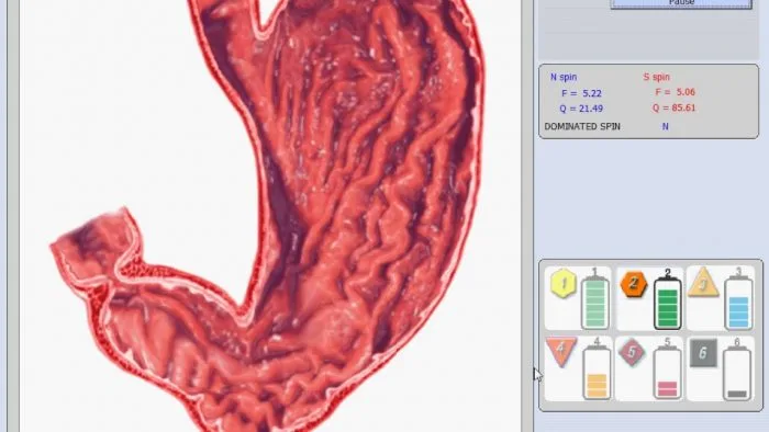 diacom nls software 14