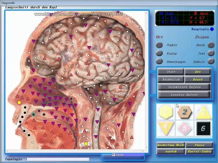 diacom nls software 7