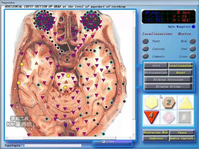 diacom nls software 8