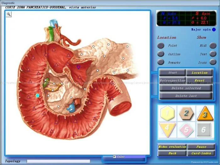 diacom nls software 9