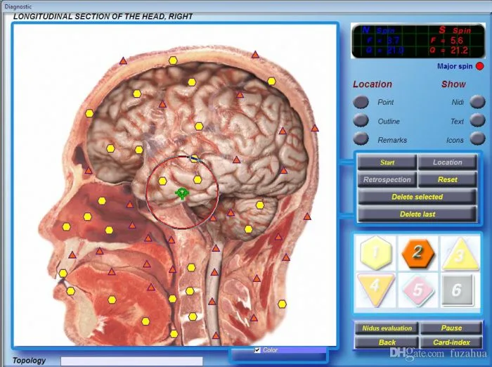 3d cell nls diagnostic and analysis 3