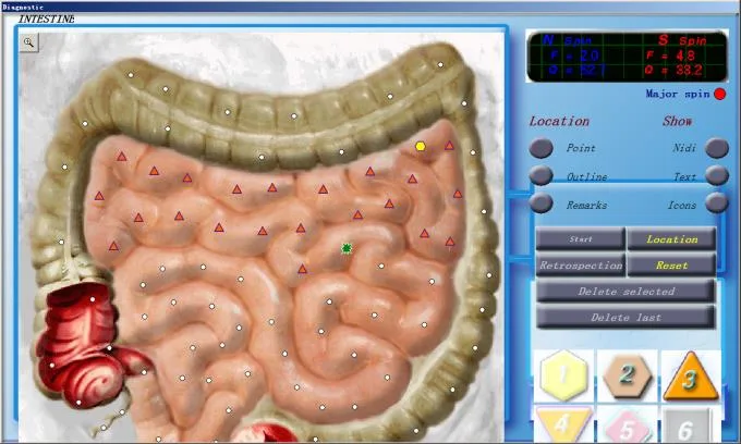 3d cell nls diagnostic and analysis