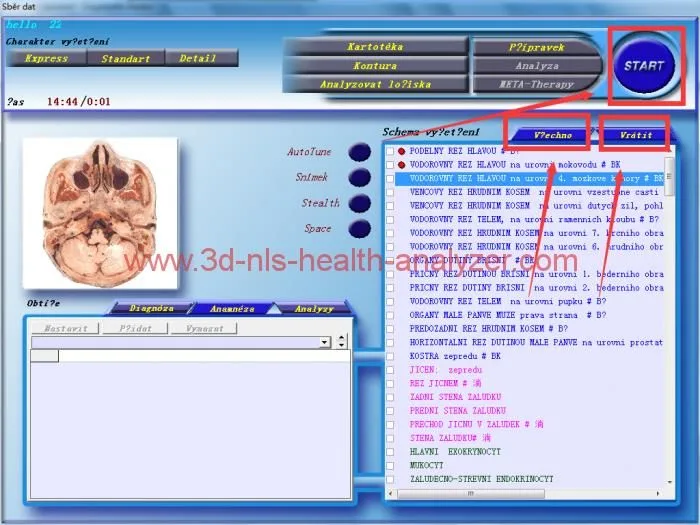3d nls diacom