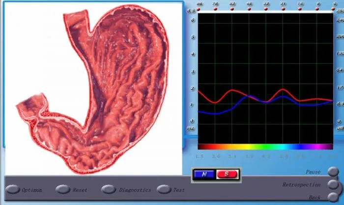 3d nls diacom