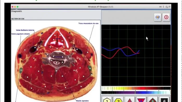 3d nls sub health analyzer